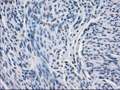 Immunohistochemistry-Paraffin: BCKDK Antibody (OTI11C9) [NBP1-47664]
