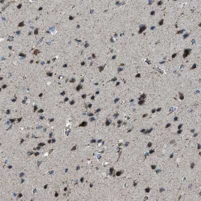 Immunohistochemistry-Paraffin: BCKDK Antibody [NBP1-86052]