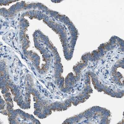 Immunohistochemistry-Paraffin: BCKDK Antibody [NBP1-86052]
