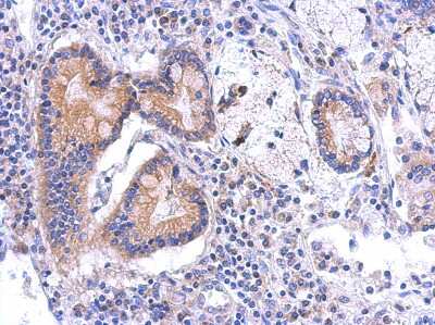 Immunohistochemistry-Paraffin: BCKDK Antibody [NBP2-15553]