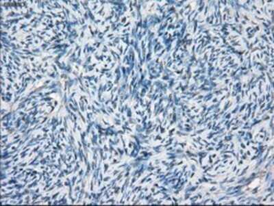 Immunohistochemistry: BCKDK Antibody (OTI11C9) - Azide and BSA Free [NBP2-71573]