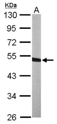 Western Blot: BCKDK Antibody [NBP2-15553]