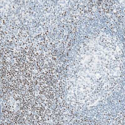 Immunohistochemistry-Paraffin: BCL11B Antibody (CL6426) [NBP2-76493]