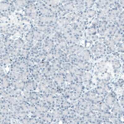 Immunohistochemistry-Paraffin: BCL11B Antibody (CL6426) [NBP2-76493]