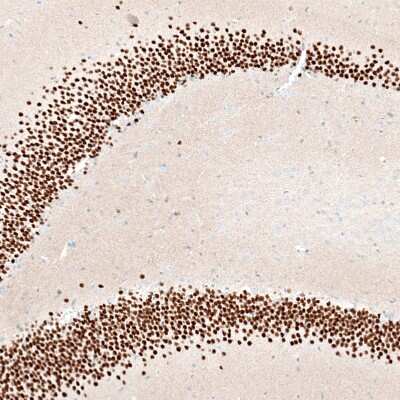 Immunohistochemistry-Paraffin: BCL11B Antibody (CL6426) [NBP2-76493]