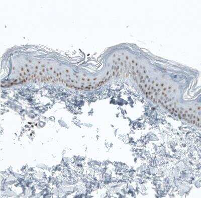 Immunohistochemistry-Paraffin: BCL11B Antibody (CL6426) [NBP2-76493]