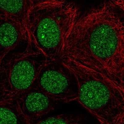Immunocytochemistry/ Immunofluorescence: BCL11B Antibody [NBP2-33549]