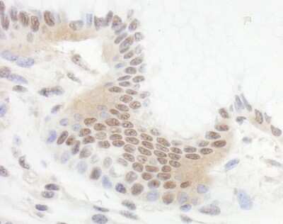 Immunohistochemistry-Paraffin: BCL11B Antibody [NB600-263]