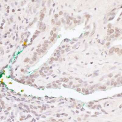 Immunohistochemistry: BCL11B Antibody [NB600-264]