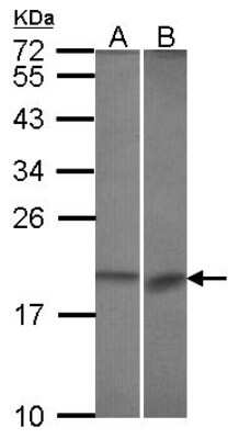 Western Blot: BCL2L10 Antibody [NBP2-15557]