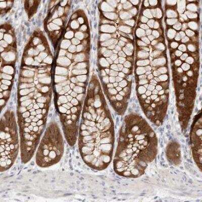 Immunohistochemistry-Paraffin: BCL2L15 Antibody [NBP1-90767]
