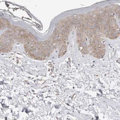 Immunohistochemistry-Paraffin: BCL2L15 Antibody [NBP1-90767]