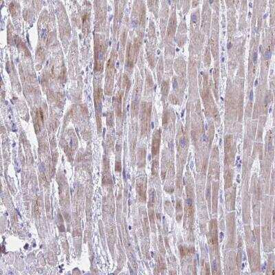 Immunohistochemistry-Paraffin: BCL6B Antibody [NBP2-31749]