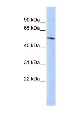 Western Blot: BCL6B Antibody [NBP1-80434]