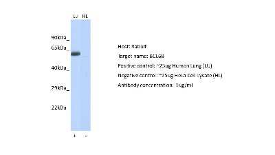 Western Blot: BCL6B Antibody [NBP1-80434]