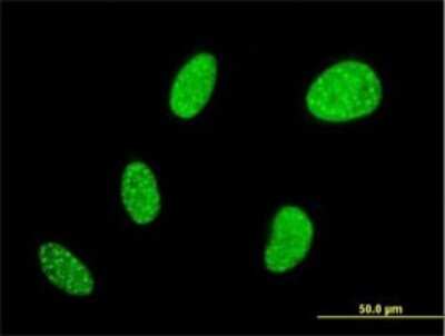 Immunocytochemistry/ Immunofluorescence: BCL7B Antibody (6D2) [H00009275-M01]