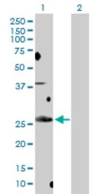 Western Blot: BCL7B Antibody [H00009275-D01P]