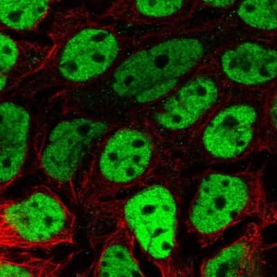 Immunocytochemistry/ Immunofluorescence: BCL9-2 Antibody [NBP2-14350]