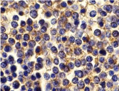 Immunohistochemistry-Paraffin: BCMA/TNFRSF17 Antibody - BSA Free [NBP1-76774]