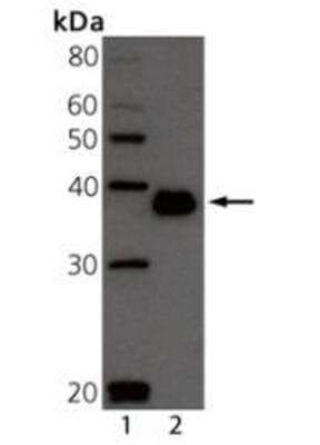 Western Blot: BCMA/TNFRSF17 Antibody (Vicky-2)BSA Free [NBP1-97608]
