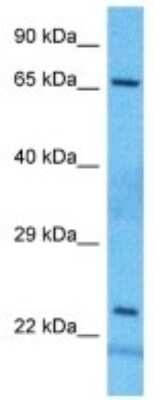 Western Blot: BCMO1 Antibody [NBP3-10784]
