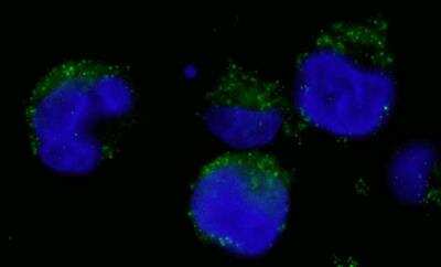 Immunocytochemistry/ Immunofluorescence: BCR Antibody [NBP1-19098]