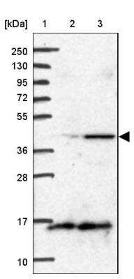 Western Blot: BCS1L Antibody [NBP1-88677]