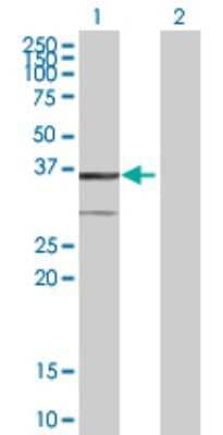 Western Blot: BDH1 Antibody [H00000622-B01P]