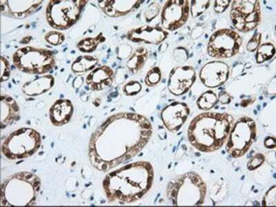 Immunohistochemistry-Paraffin: BDH2 Antibody (OTI2G1) [NBP2-02651]