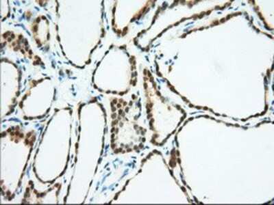 Immunohistochemistry-Paraffin: BDH2 Antibody (OTI2G1) [NBP2-02651]