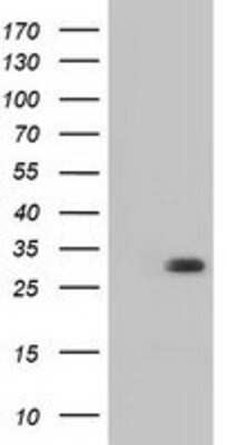 Western Blot: BDH2 Antibody (OTI2G1) [NBP2-02651]
