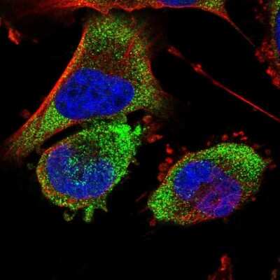 Immunocytochemistry/ Immunofluorescence: BDH2 Antibody [NBP2-32713]