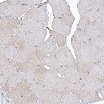 Immunohistochemistry-Paraffin: BDH2 Antibody [NBP1-85218]