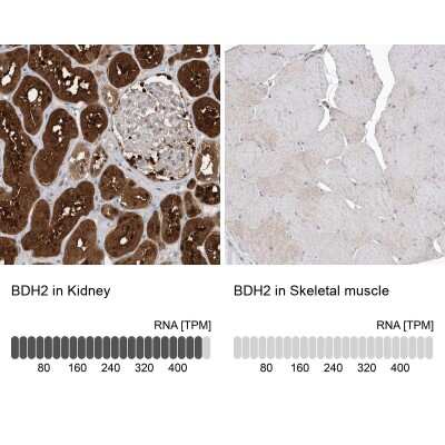 Immunohistochemistry-Paraffin: BDH2 Antibody [NBP1-85218]