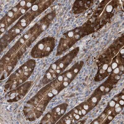 Immunohistochemistry-Paraffin: BDH2 Antibody [NBP1-85218]