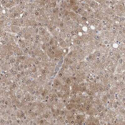Immunohistochemistry-Paraffin: BDH2 Antibody [NBP1-85218]