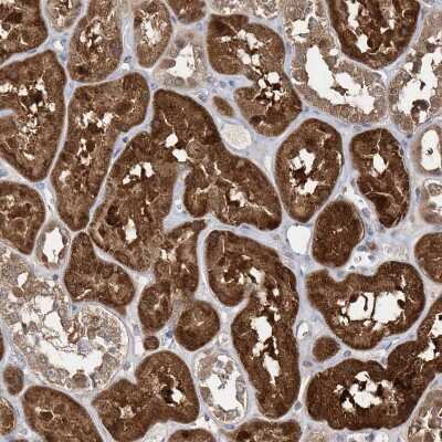 Immunohistochemistry-Paraffin: BDH2 Antibody [NBP2-32713]