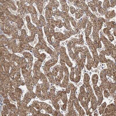 Immunohistochemistry-Paraffin: BDH2 Antibody [NBP2-32713]