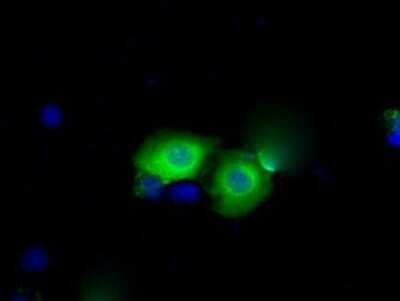 Immunocytochemistry/ Immunofluorescence: BDH2 Antibody (OTI2G1) - Azide and BSA Free [NBP2-72067]