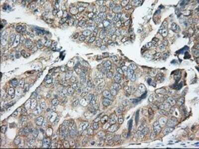 Immunohistochemistry: BDH2 Antibody (OTI2G1) - Azide and BSA Free [NBP2-72067]