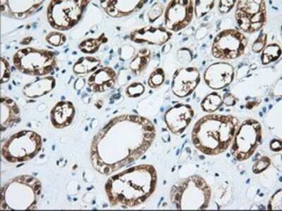Immunohistochemistry: BDH2 Antibody (OTI2G1) - Azide and BSA Free [NBP2-72067]