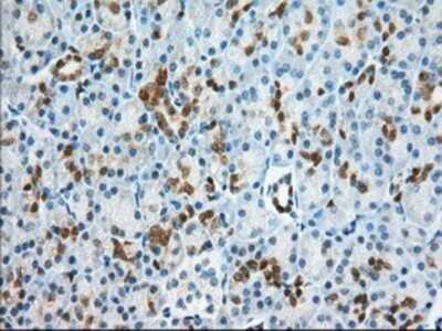 Immunohistochemistry: BDH2 Antibody (OTI2G1) - Azide and BSA Free [NBP2-72067]