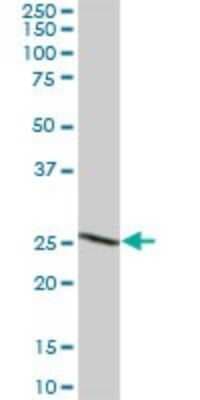 Western Blot: BDH2 Antibody [H00056898-B01P]