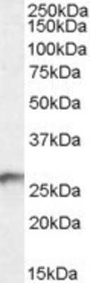 Western Blot: BDH2 Antibody [NB100-93379]