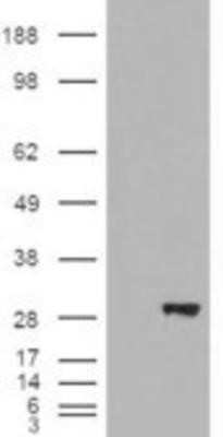 Western Blot: BDH2 Antibody [NB100-93379]