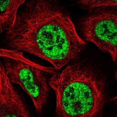 Immunocytochemistry/ Immunofluorescence: BDNF Antibody [NBP2-55052]