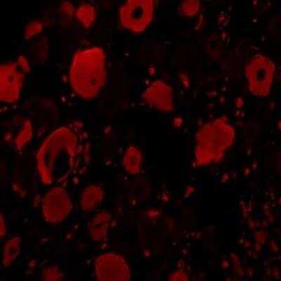 Immunohistochemistry: BDNF Antibody - Azide and BSA Free [NB100-98683]