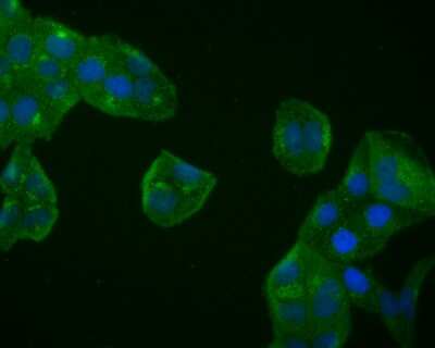 Immunocytochemistry/ Immunofluorescence: BDNF Antibody (SJ12-09) [NBP2-67410]