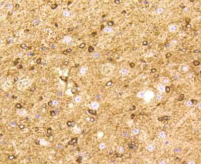 Immunohistochemistry-Paraffin: BDNF Antibody (SJ12-09) [NBP2-67410]