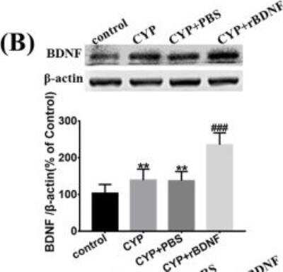 Western Blot: BDNF Antibody [NB100-98682]